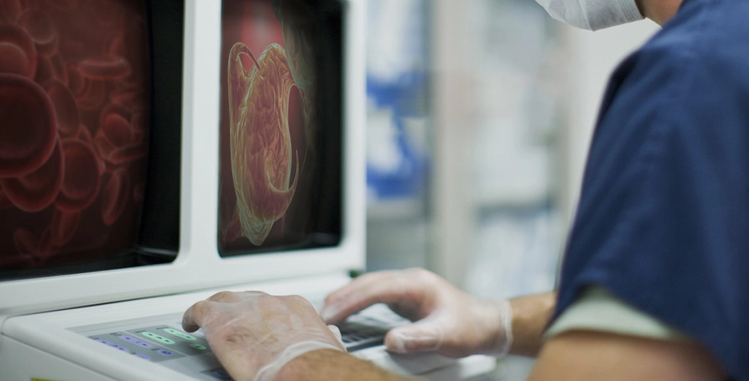Membrane Switches in Medical Equipment